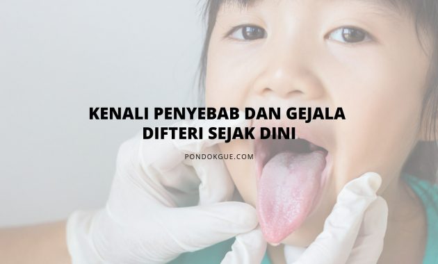 Kenali Penyebab dan Gejala Difteri Sejak Dini