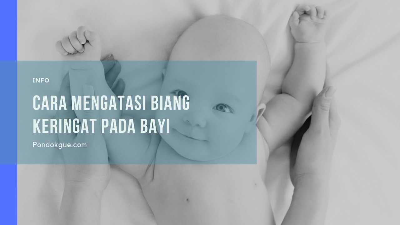 Cara Mengatasi Biang Keringat Pada Bayi