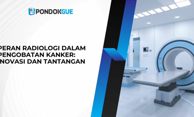 Peran Radiologi dalam Pengobatan Kanker