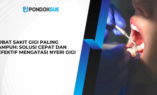 Obat Sakit Gigi Paling Ampuh